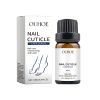 OUHOE Nail Essence Moisturizes Nails, Strengthens Nails, Cleans Gray Nails, Restores Nails And Nourishes Nails